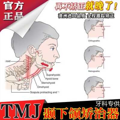 下颌肌功能训练有用吗（下颌后缩肌功能训练）