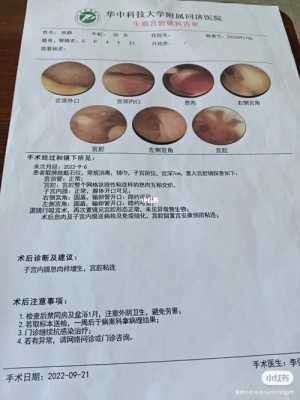 单纯宫腔镜检查有用吗（单纯做宫腔镜检查有副作用吗）