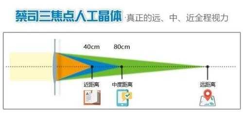 多焦点到底有用没（多焦点是什么）