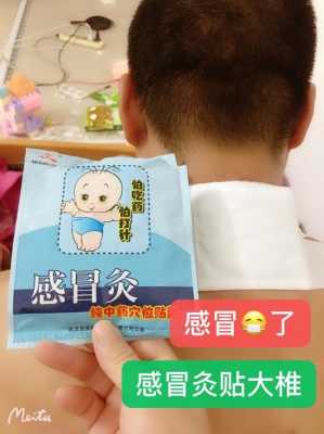 幼儿感冒贴中药贴有用吗（儿童感冒贴中药贴贴在哪）