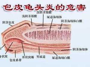 龟头有用浓性分泌物的简单介绍