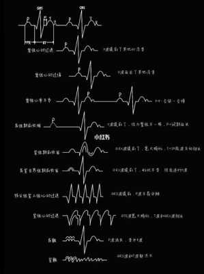 心电图有用（如何看懂心电图）