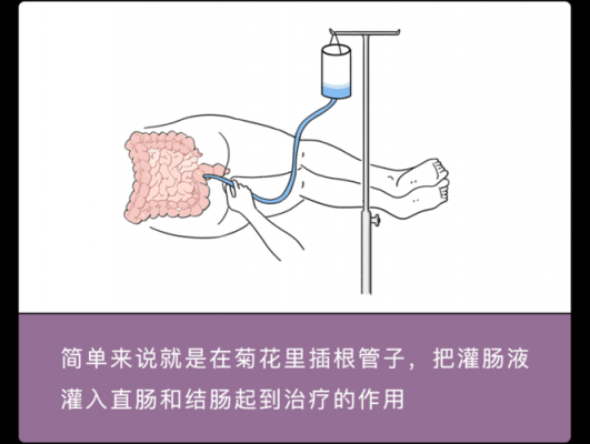 灌肠到底有没有用（灌肠能起什么作用）