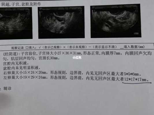 卵泡检查有用吗（卵泡检测贵不贵）