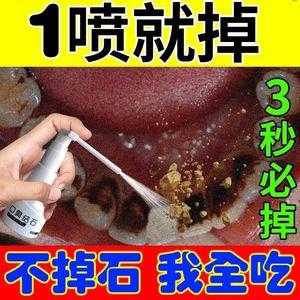 醋对牙结石有用吗（醋能去牙齿结石吗）