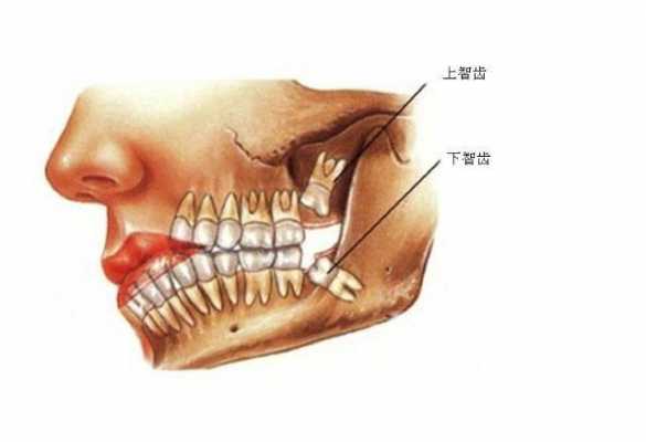 智慧齿有用吗（智慧牙对身体有什么影响）