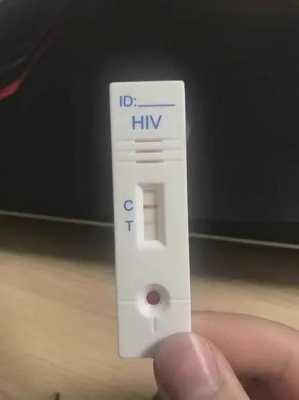 hiv抗体定量有用吗（艾滋病抗体检测定量准还是定性准）