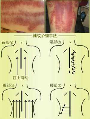 腰酸背痛刮痧有用吗（腰酸刮痧刮哪里）