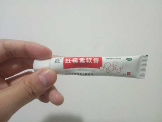 红霉素脸上痘痘有用吗（红霉素长痘痘可以涂吗）