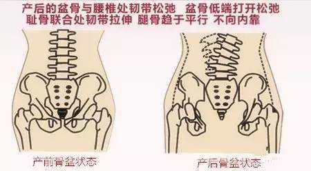 产后修复手法有用吗（骨盆修复手法按真有效吗）