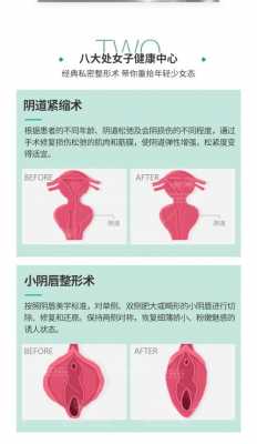 私密紧缩有用吗（私密收紧手术是什么）