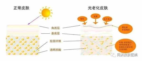 抗光老有用吗（抗光老化分为几个方面）