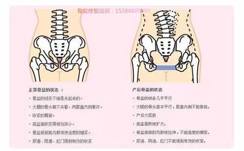 产后骨盆肌电疗有用吗（产后做骨盆肌修复后悔死了）