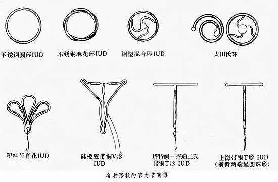 子宫肌瘤带环有用（子宫肌瘤带环有用吗）