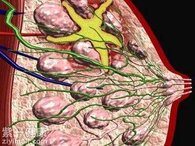 乳腺增生热水敷有用吗（乳腺增生热敷管事吗）