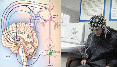 脑神经递质检查有用吗（脑神经递质检测方法）