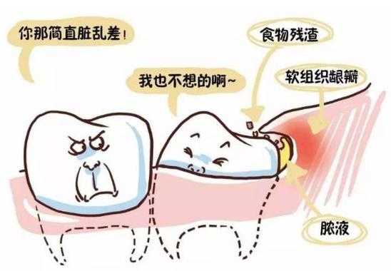 长智齿牙疼含热水有用不（长智齿喝热水能止痛吗）