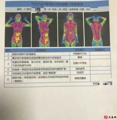 体检做热成像有用吗（体检做热成像有用吗多少钱）