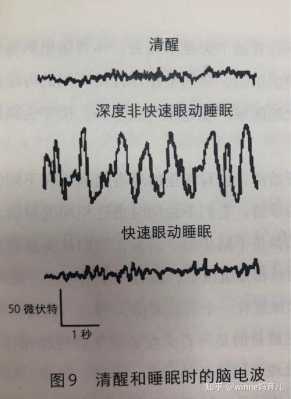 失眠电波疗法有用吗（失眠电波疗法有用吗知乎）