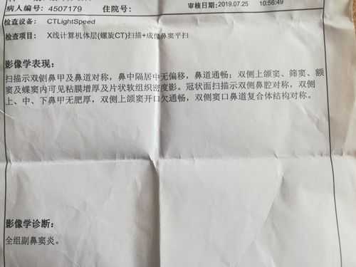 鼻痒做脑ct有用吗（鼻孔痒做什么检查）