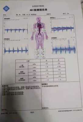 多普勒检查有用吗（多普勒检查对身体有害吗）