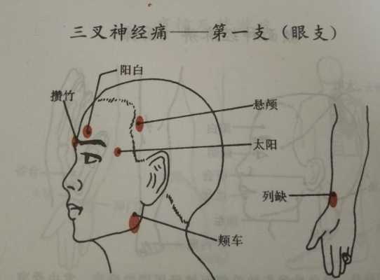 关于三叉神经痛针灸有用吗的信息