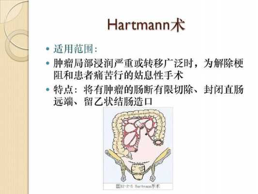 消融术对肠癌有用吗（消融手术适合直肠癌吗）