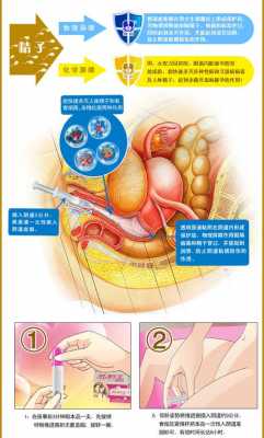 女用液体避孕套有用吗（女用液体避孕套防艾滋吗）