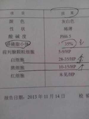 化验前列腺液有用吗（查前列腺液有什么用）