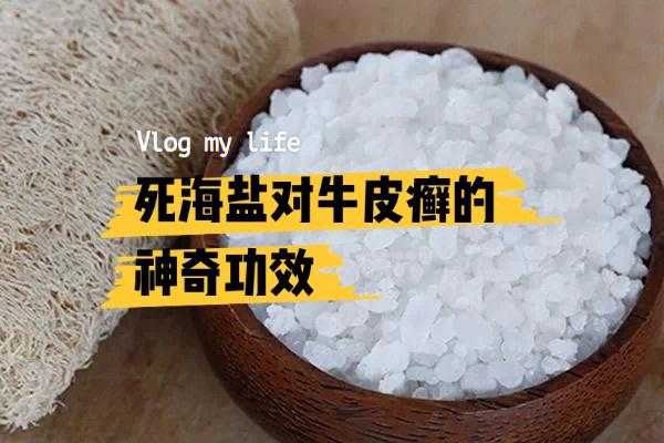 用盐水洗癣有用吗（盐水对癣有效果不?）