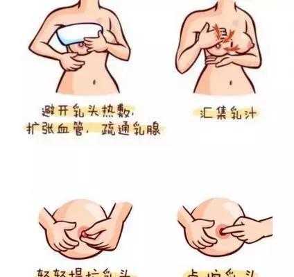 没母乳催奶有用吗（没有母乳怎么退奶）