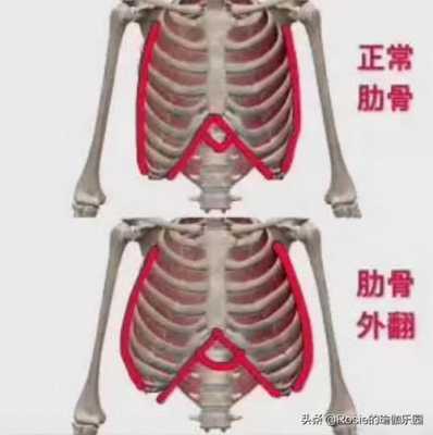 肋骨外翻去医院有用吗（肋骨外翻去医院有用吗多少钱）