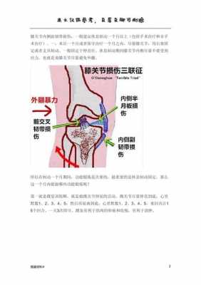 膝盖韧带拉伤能有用么的简单介绍