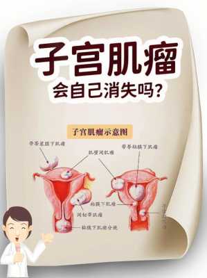 磁疗对子宫肌瘤有用吗（磁波治疗子宫肌瘤多久可以怀孕）