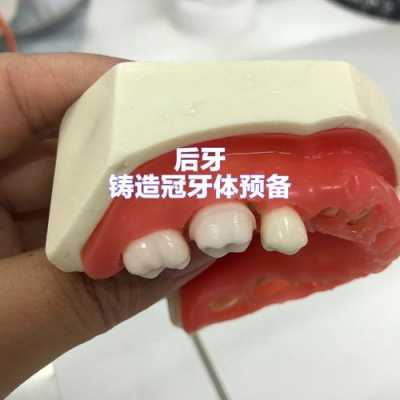 后牙动了留着有用吗（后牙活动了怎么办）