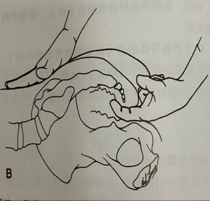 尾骨错位能有用么（尾骨错位多长时间恢复）