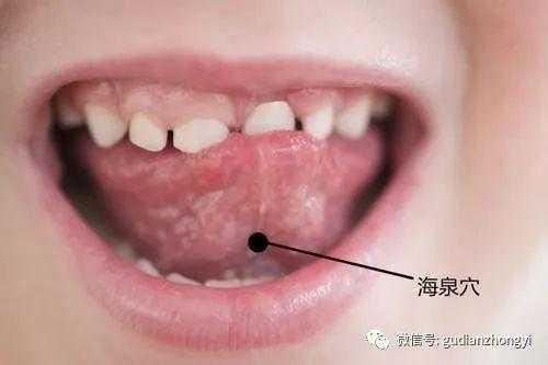 口腔溃疡那个穴位有用的简单介绍