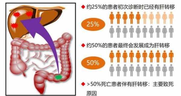 肝转移化疗有用吗（转移肝癌化疗有用吗）