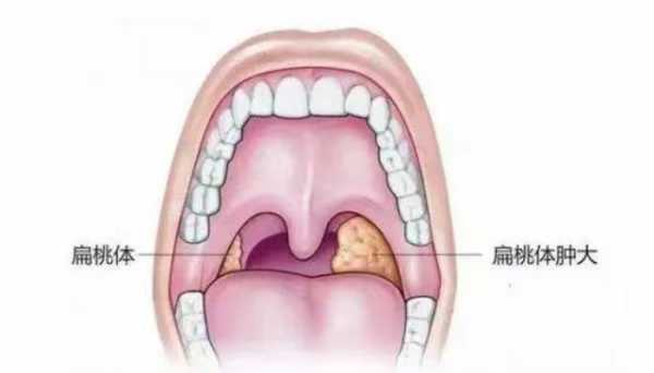 腺样体有用吗（腺样体有什么作用）