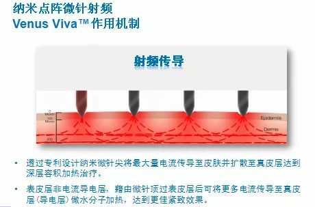 纳米理疗仪有用吗（纳米治疗仪的治病原理）