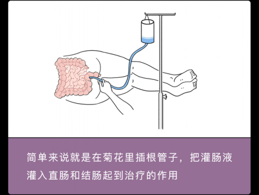 灌肠退烧有用吗（灌肠退烧有什么副作用）