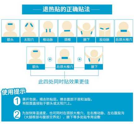 39度用退烧贴有用吗有用（39度退热贴可以贴在哪些部位）